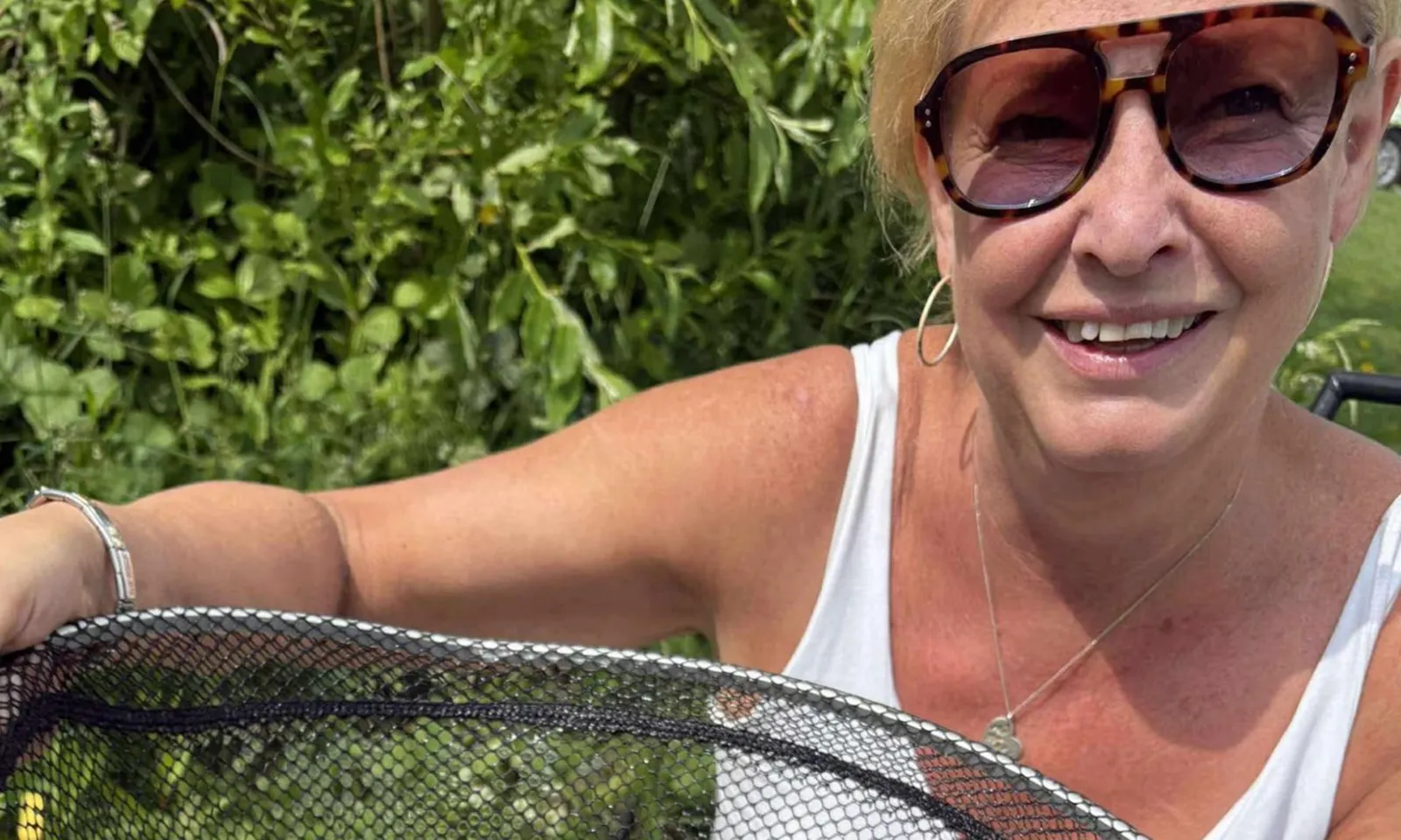 Người phụ nữ tử vong vì bệnh dại sau khi tiếp xúc với chó hoang