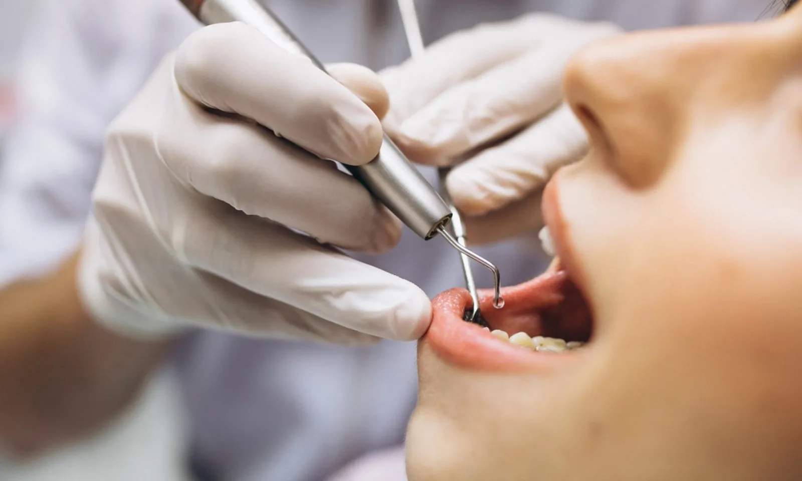 Bắt giữ nha sĩ dỏm học nghề trên mạng rồi chữa trị cho hàng chục bệnh nhân