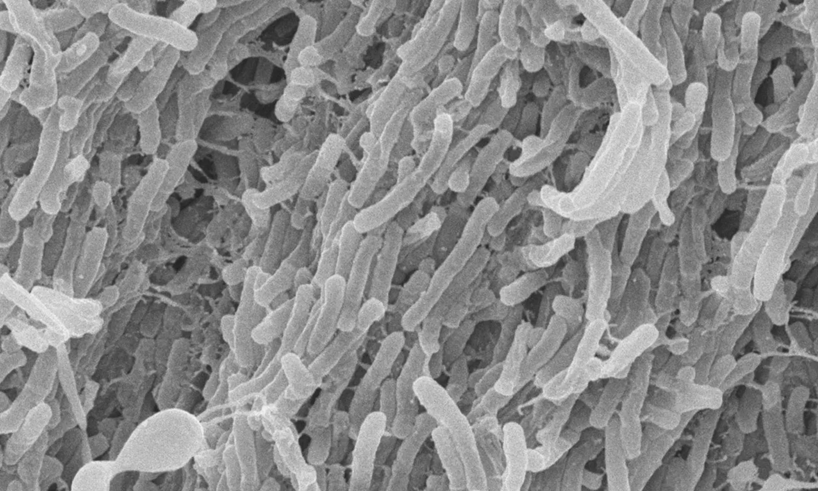 Từ tháng 9/2025: Người Việt lưu trú quá 3 tháng tại Nhật Bản sẽ phải kiểm tra bệnh lao