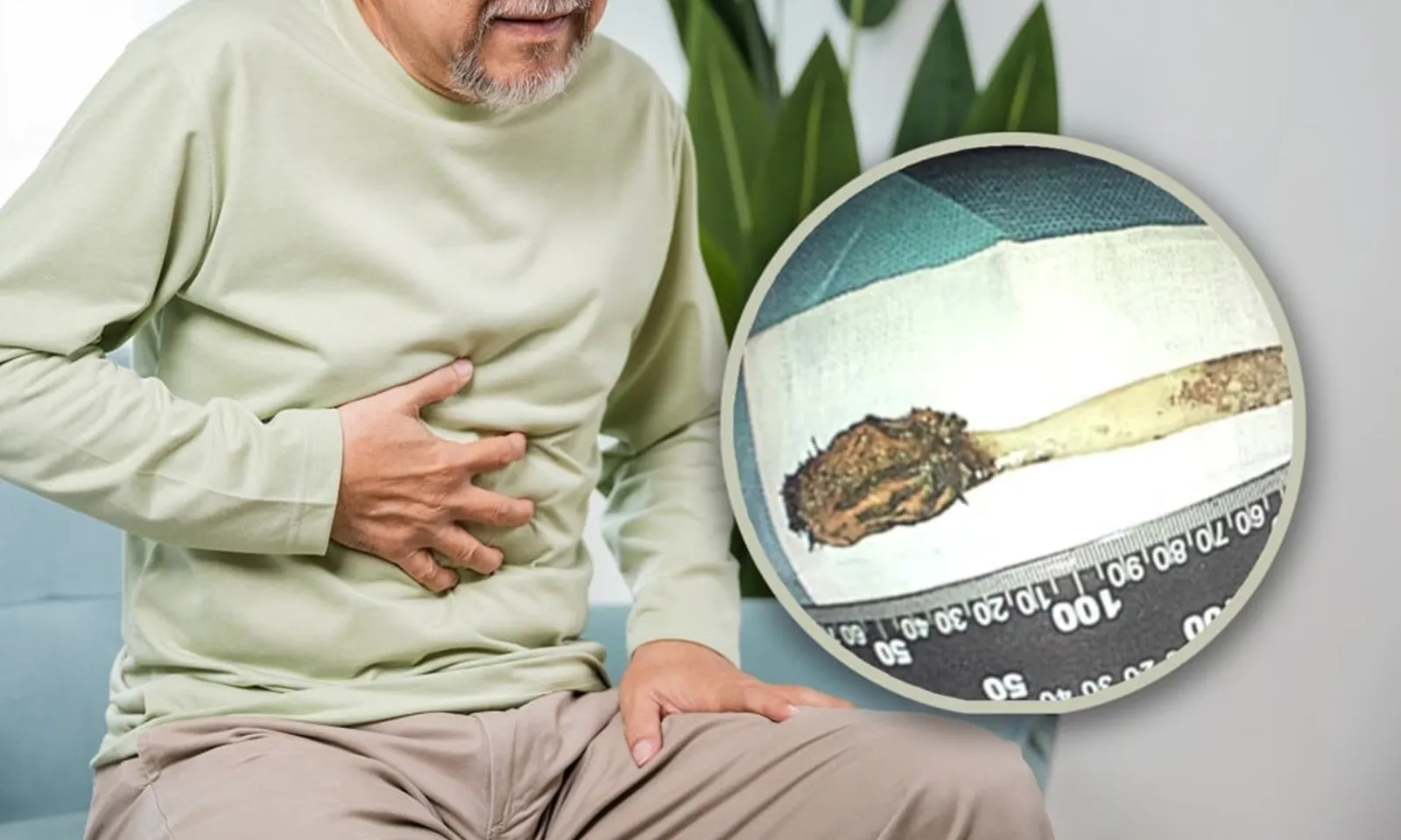 Bàn chải đánh răng mắc kẹt trong ruột người đàn ông suốt 52 năm