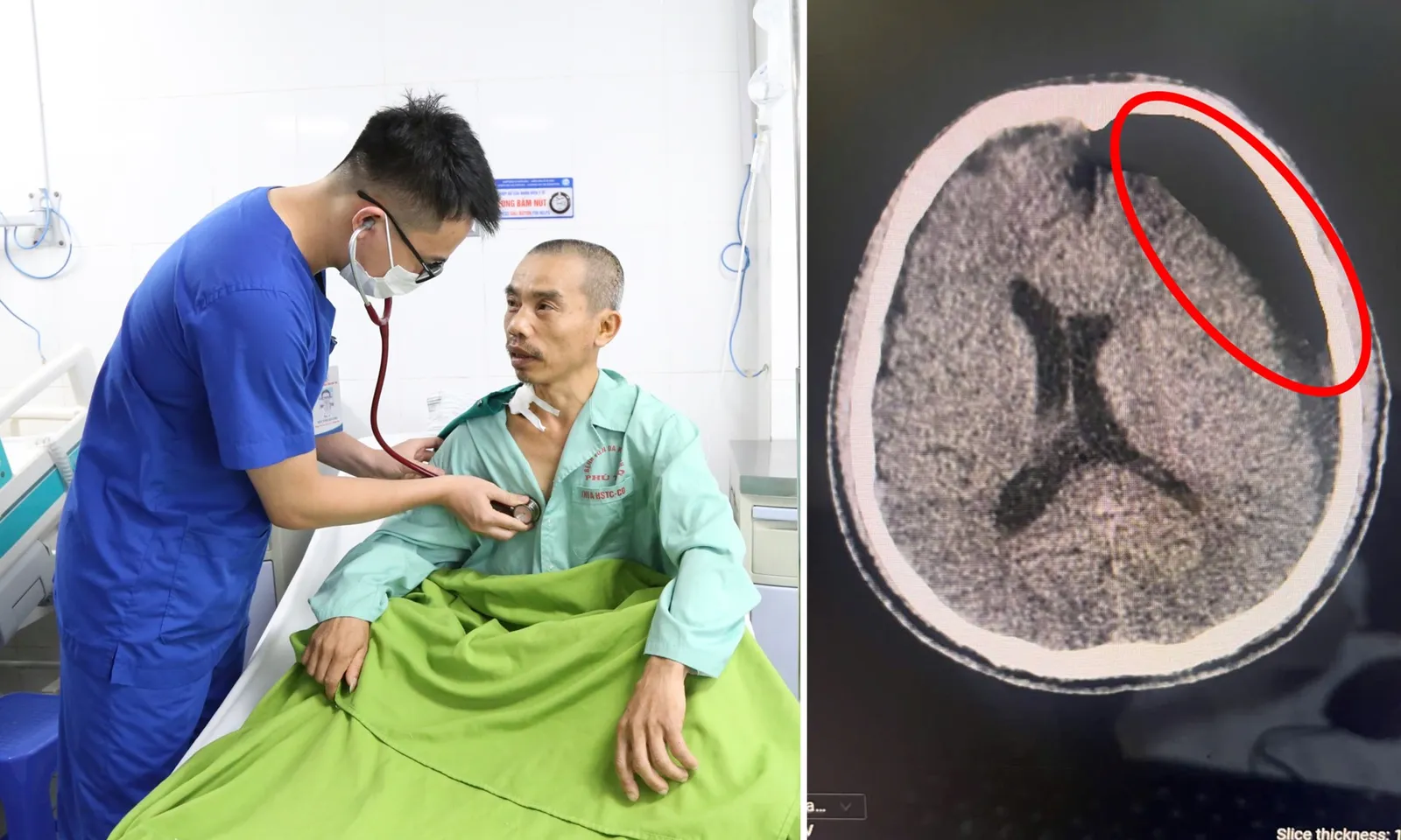 Người đàn ông bất ngờ hôn mê sau 2 tháng ngã xe đạp điện