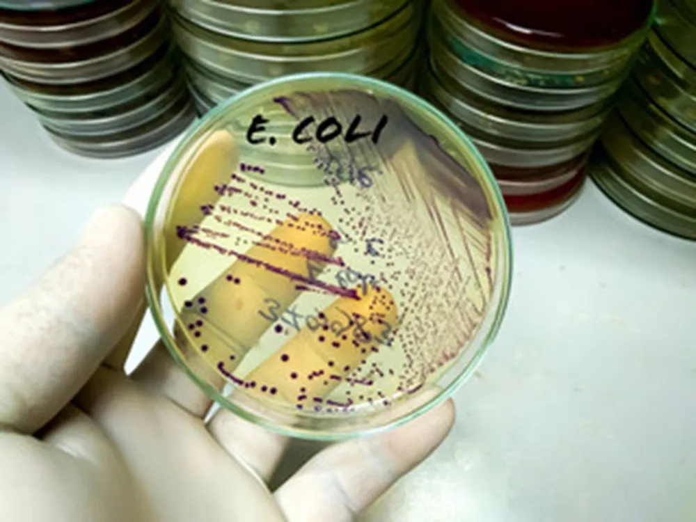 Ecoli
