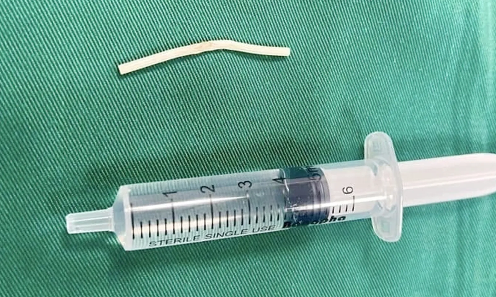 Nhập viện do que cấy tránh thai “đi lạc” trong bắp tay