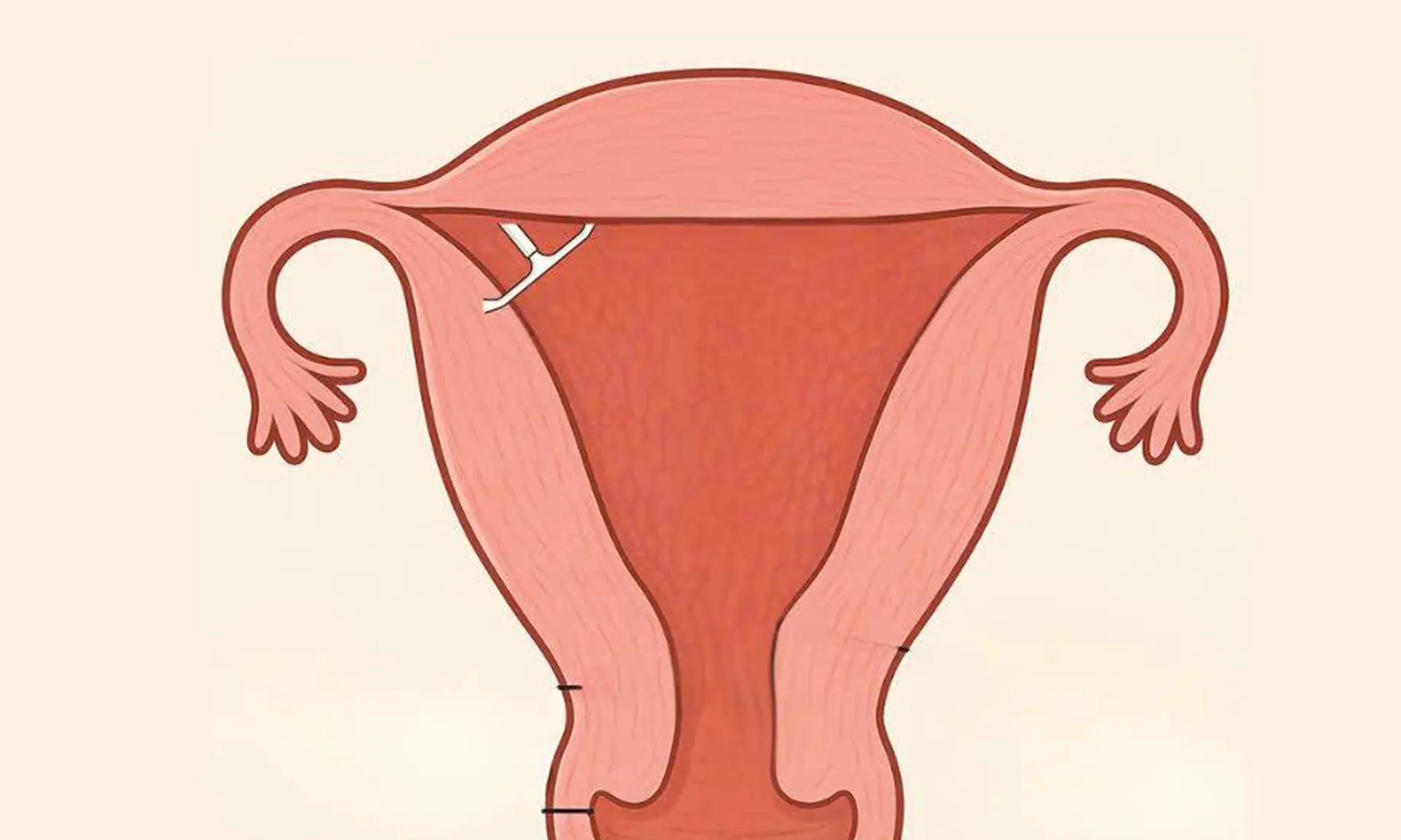 vong-tranh-thai-270625