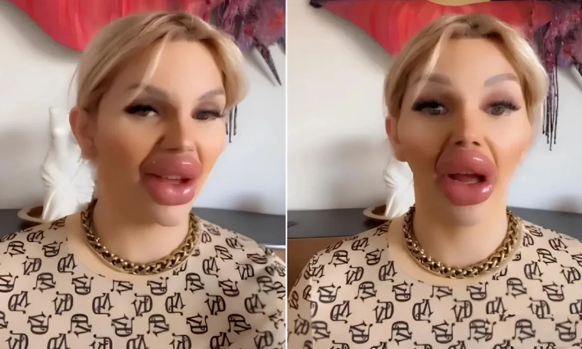 Không thể khép miệng vì nghiện đẹp