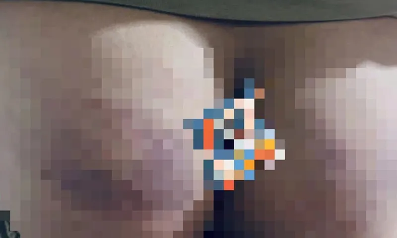 Cô giáo đánh bầm mông học sinh vì làm không đúng bài cô giao