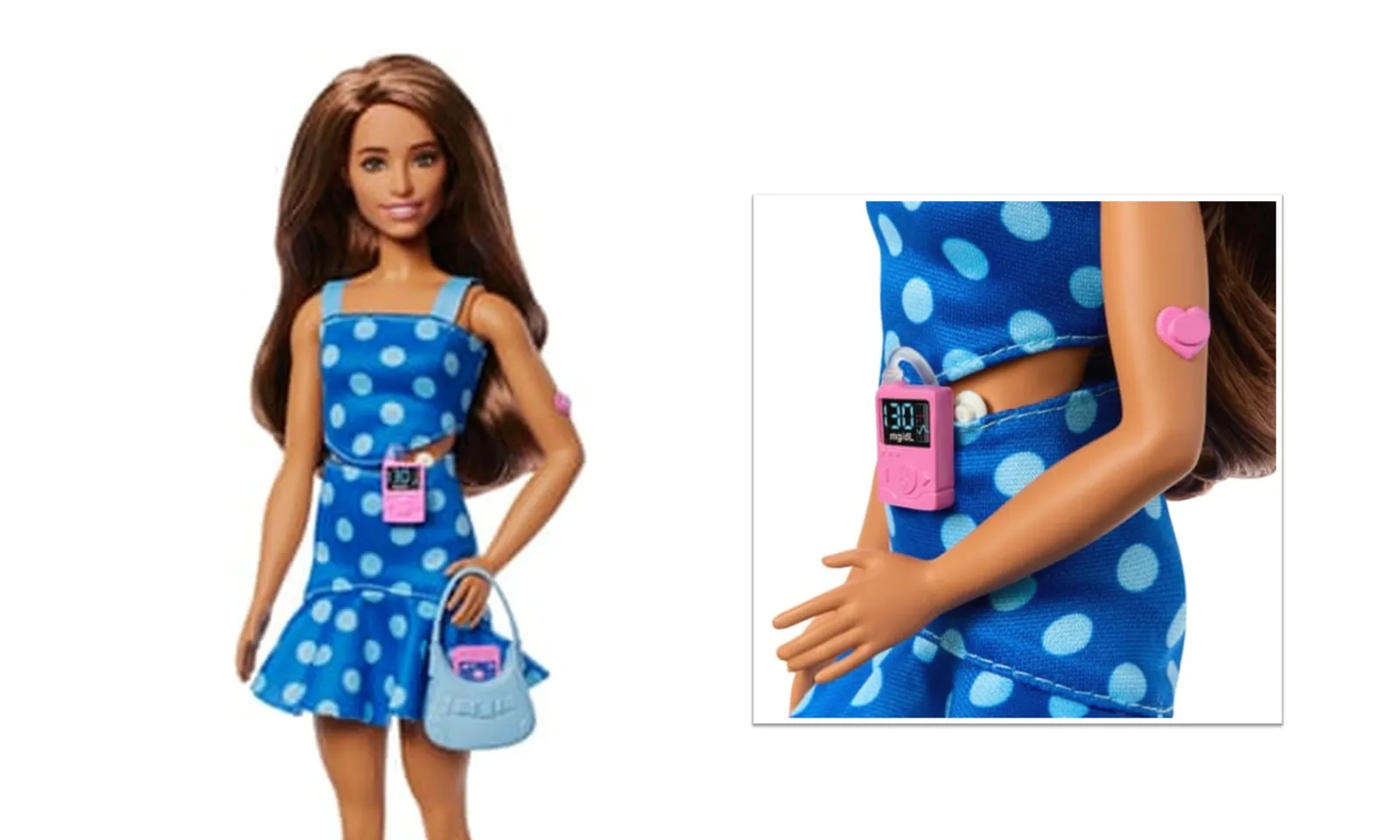 Barbie ra mắt búp bê mắc bệnh tiểu đường type 1