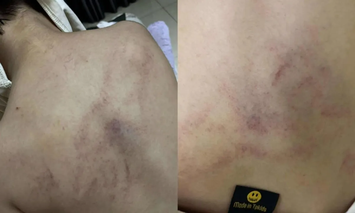 Giáo viên mầm non bị tố đánh trẻ 4 tuổi, kéo lê và ném vào tường