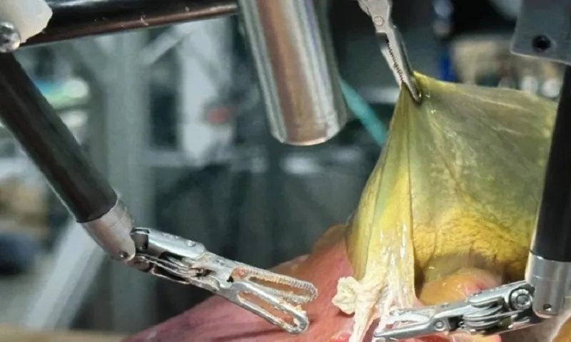 robot phẫu thuật