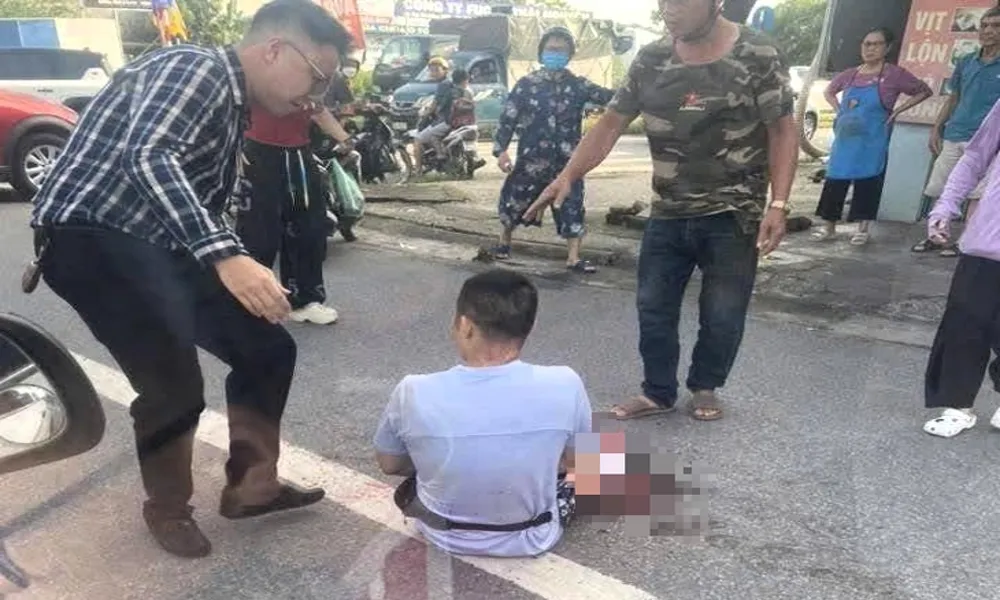 Điều tra vụ TikToker nổi tiếng bị nhóm người chém trọng thương trên phố