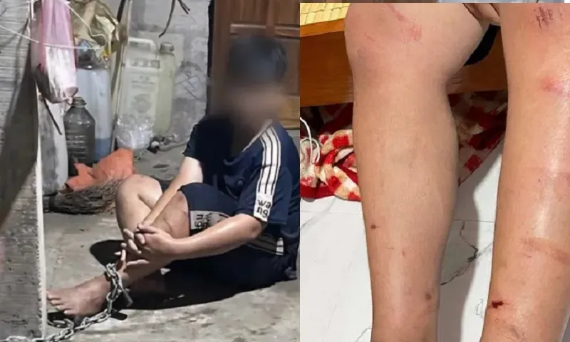 Huế: Xác minh vụ thiếu niên 13 tuổi bị xích chân và hành hung dã man 