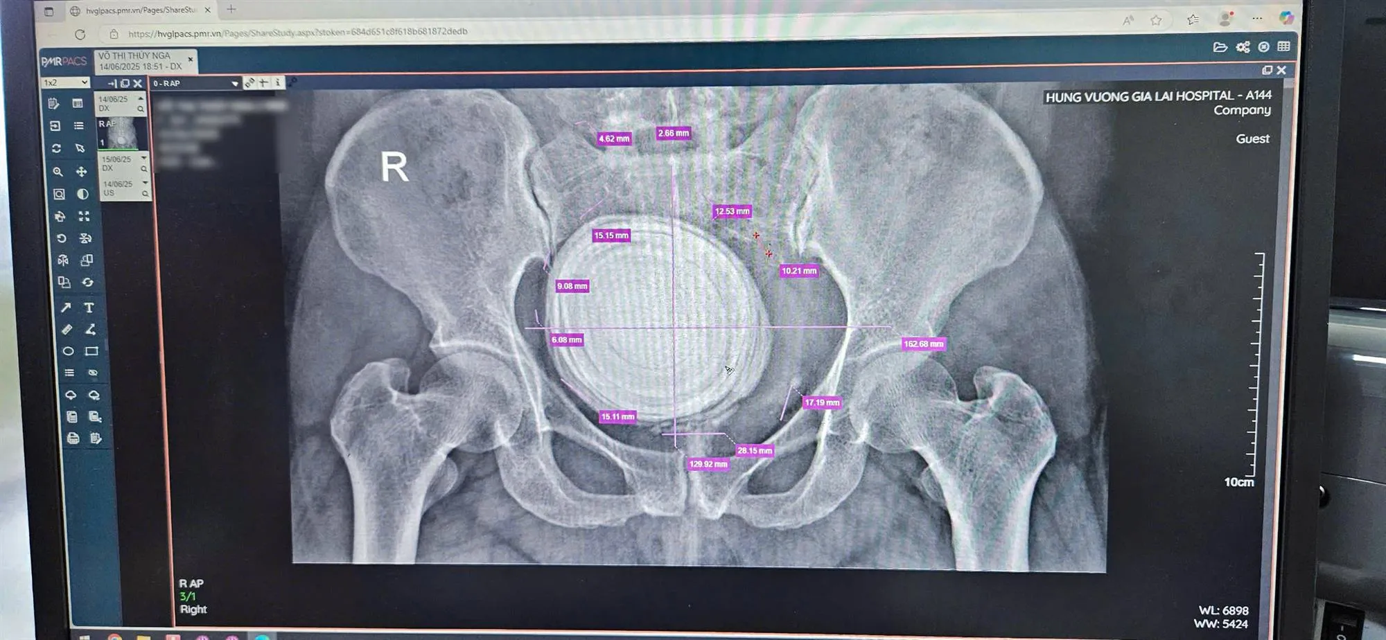 z6810647991986dd1618fbd25b1996cdbd8ed5003a2745-1752664784845294726698
