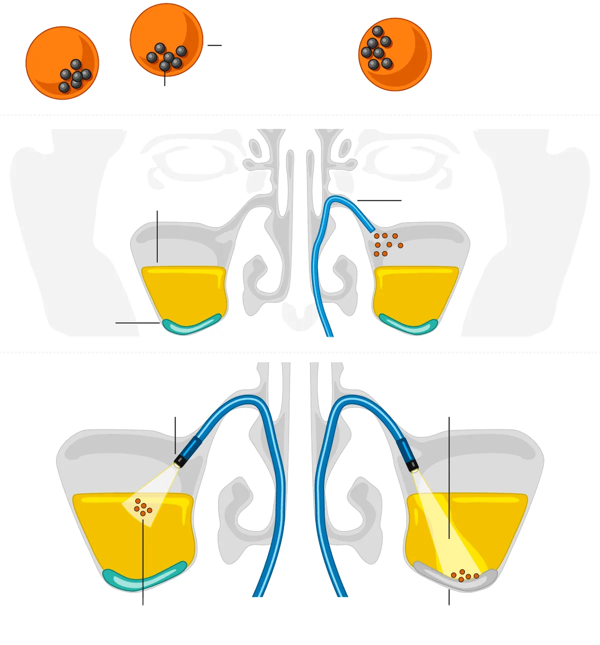 sinus-microrobots-inarticle-620