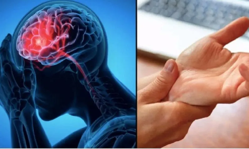 Bé trai 13 tuổi bị đột quỵ nhồi máu não