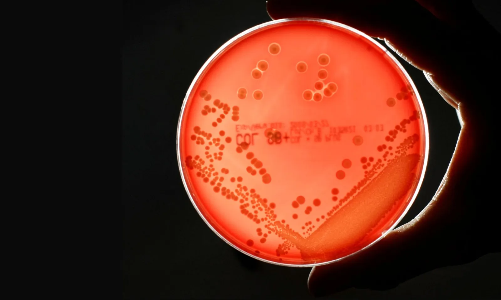 Kháng thuốc kháng sinh có thể khiến hàng triệu người tử vong, thiệt hại 2 nghìn tỷ USD mỗi năm