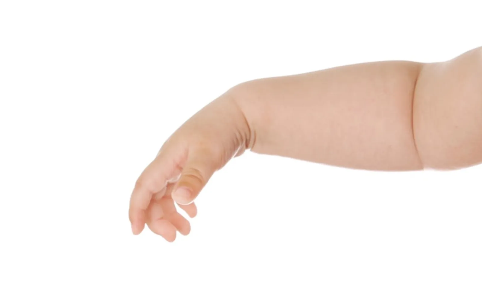 Bé gái nặng 4,7 kg sang chấn sản khoa trong quá trình sinh thường