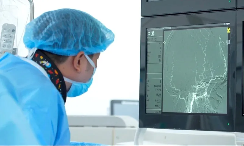 Tầm soát đột quỵ bất ngờ phát hiện khối u não khổng lồ, bệnh nhân được cứu sống kịp thời