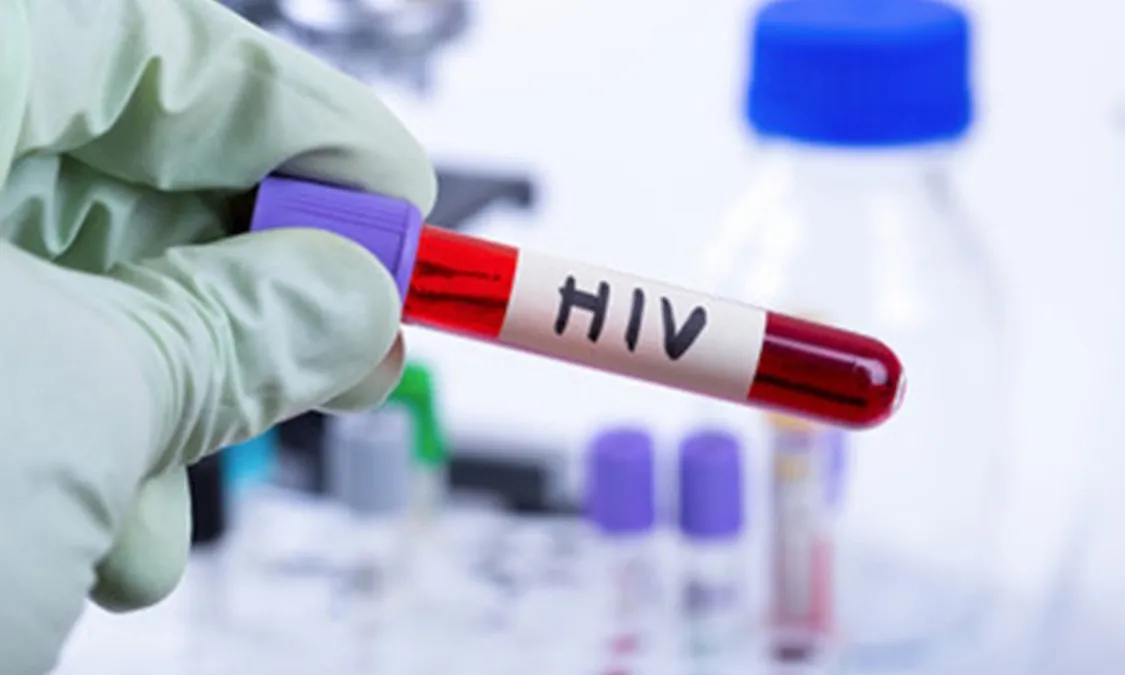 Liệu pháp gen đơn liều có thể giúp trẻ sơ sinh miễn nhiễm HIV trong nhiều năm