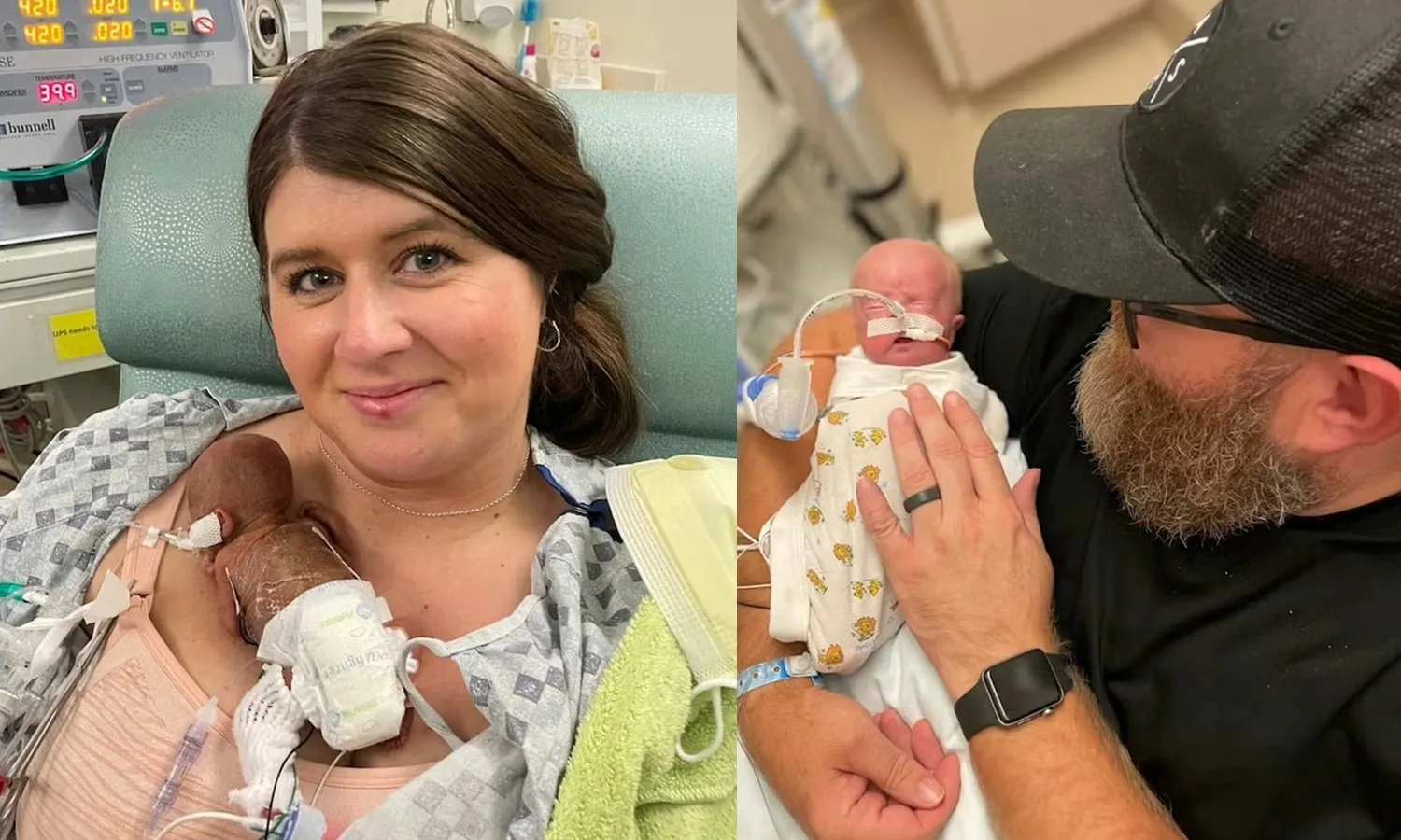 Bé trai sinh non ở tuần thai thứ 21 được công nhận kỷ lục Guinness thế giới