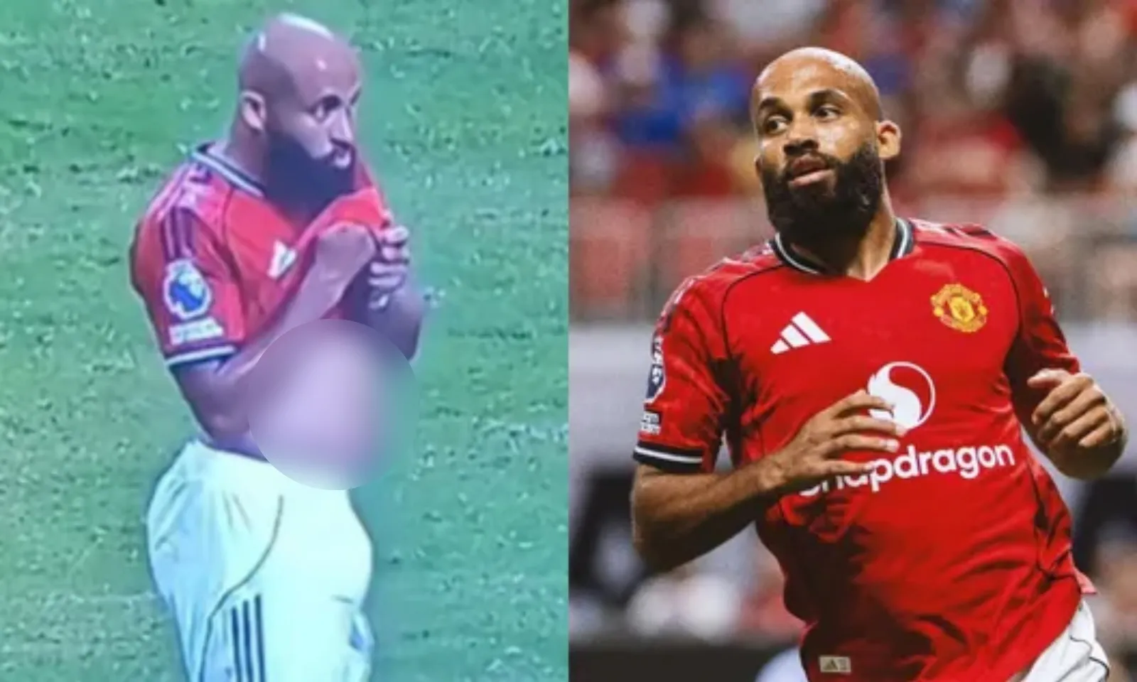 Sự thật bức ảnh Mbeumo lộ bụng phệ