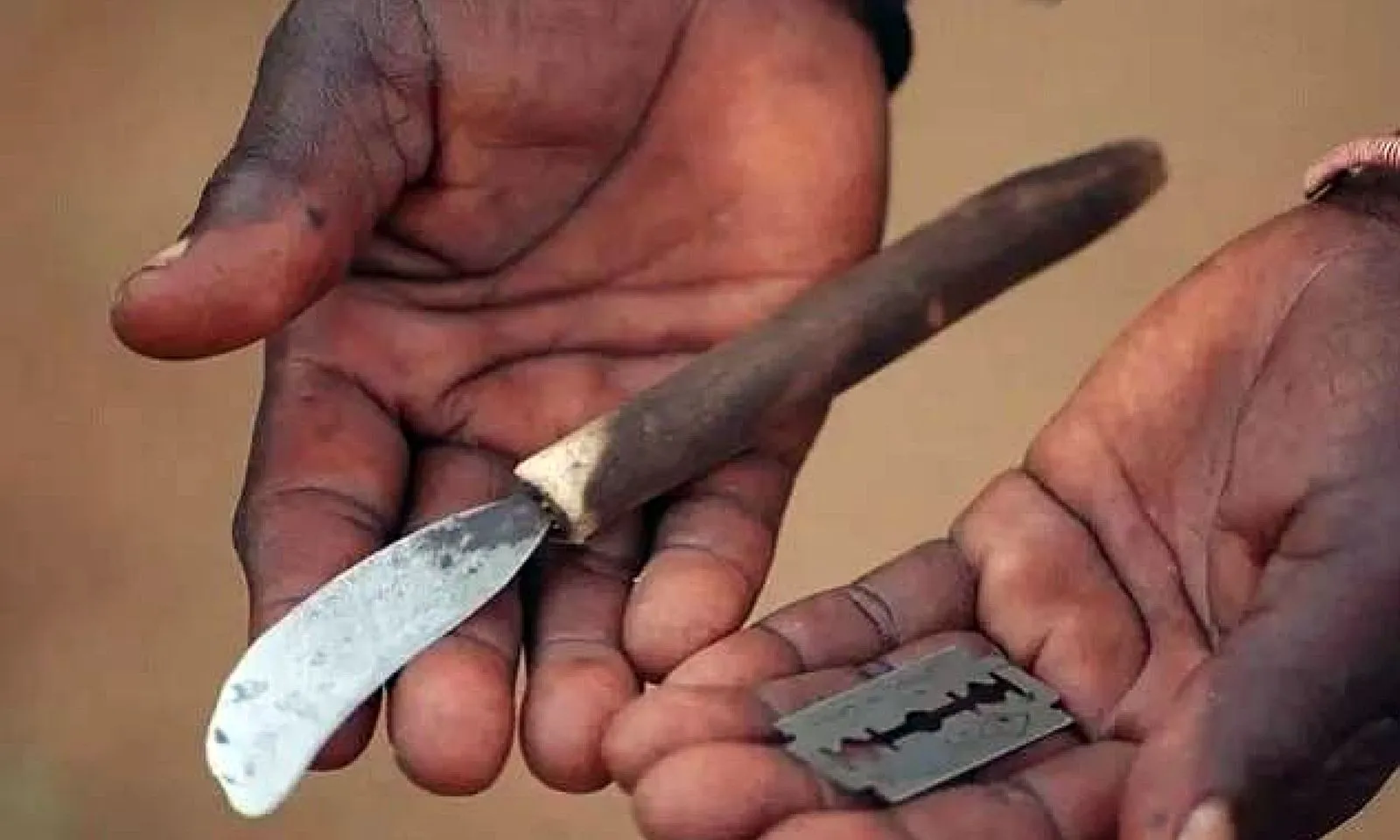 Thảm kịch từ nghi lễ cắt bao quy đầu: 361 thiếu niên tử vong trong 5 năm