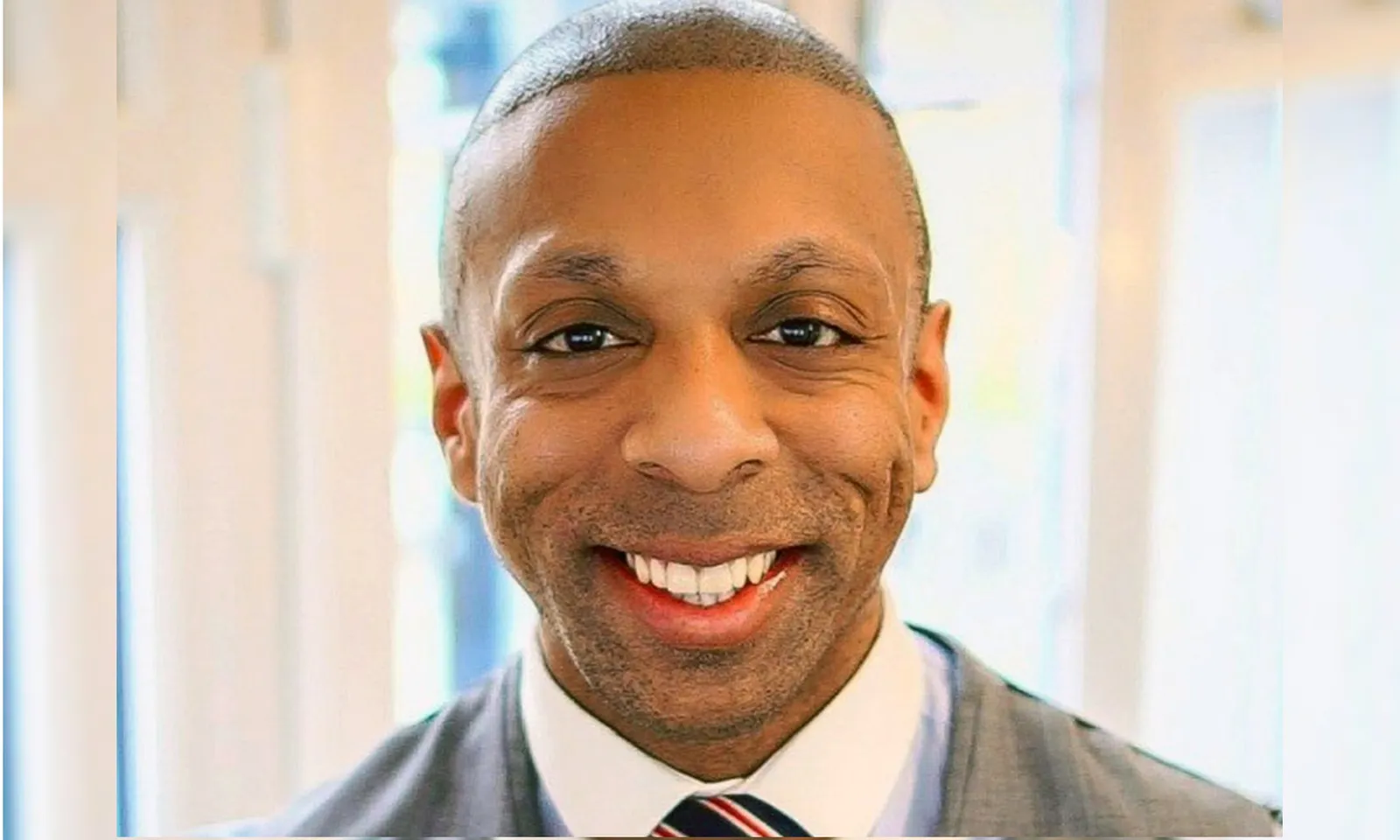 Người đàn ông Anh tử vong trong quá trình cấy tóc ở Thổ Nhĩ Kỳ