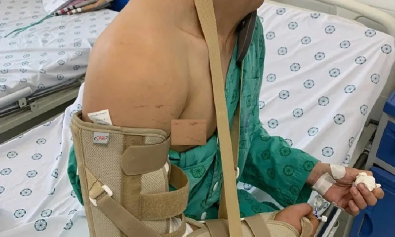 Chơi vật tay với bạn, nam thanh niên phải nhập viện điều trị - Ảnh BV Đa khoa Hà Đông