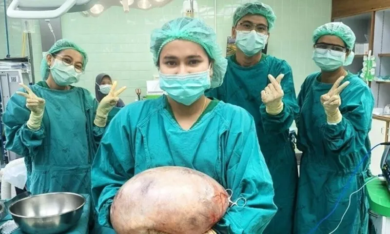 Thái Lan: Một phụ nữ mang trong người khối u nang buồng trứng khổng lồ nặng 8kg