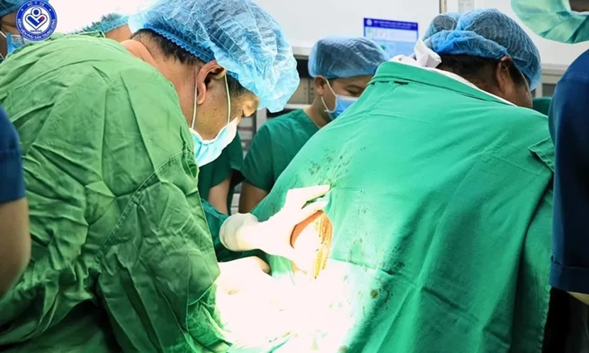 Ca mổ hiếm gặp cho sản phụ béo phì nặng 178kg kèm nhiều bệnh lý phức tạp