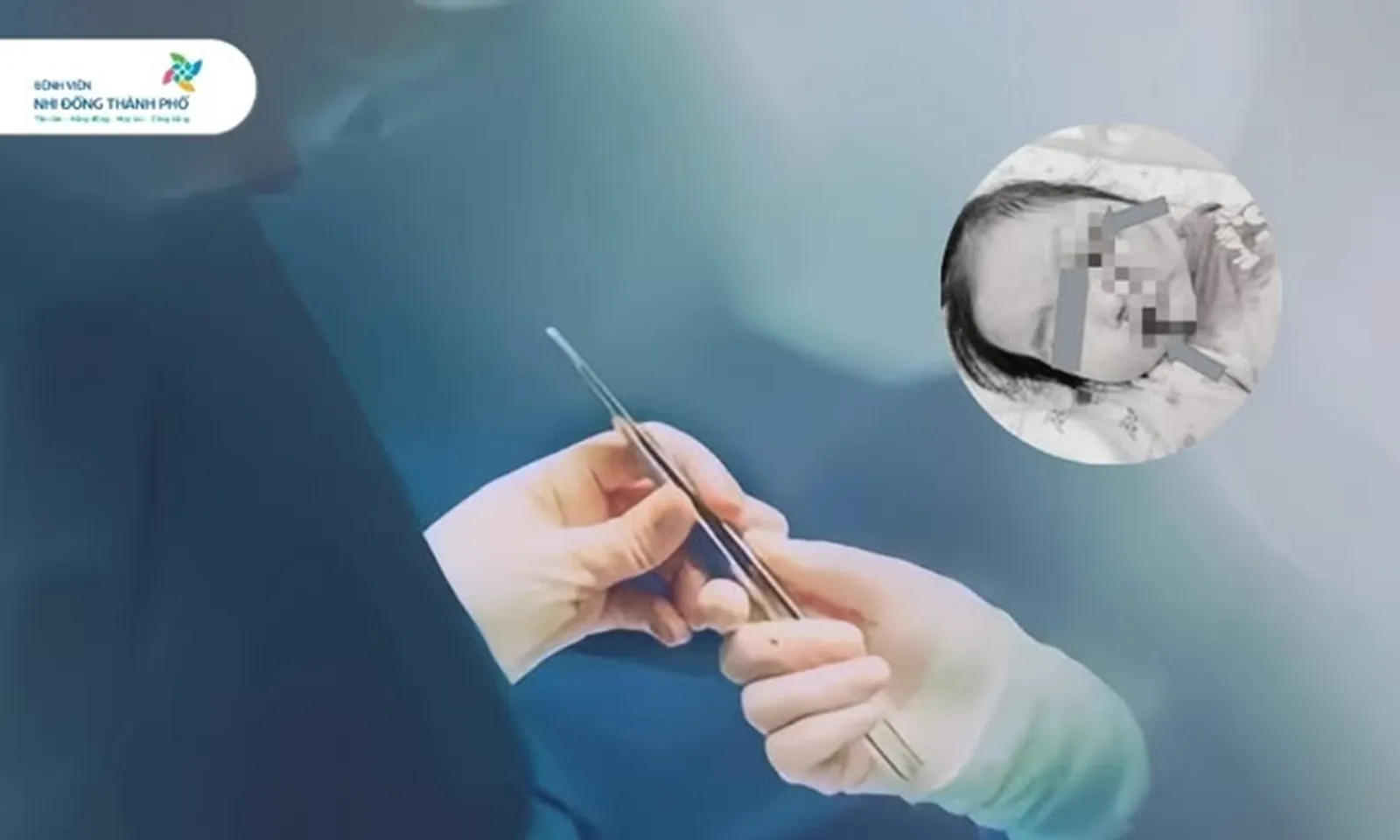 Bé gái 2 tuổi chấn thương nghiêm trọng khi vịn vào xe tay ga đang nổ máy