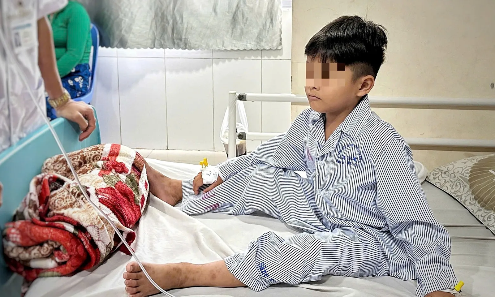 Bé trai 6 tuổi thủng ruột sau khi nuốt 4 viên nam châm