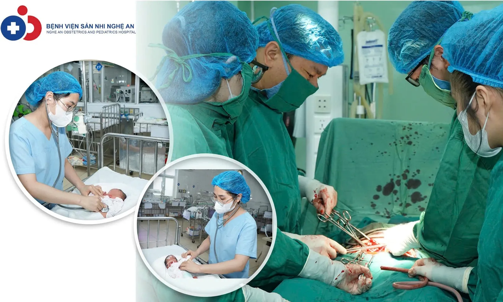 Cứu sống cặp song thai chênh nhau 1 kg, một bé chậm tăng trưởng nặng