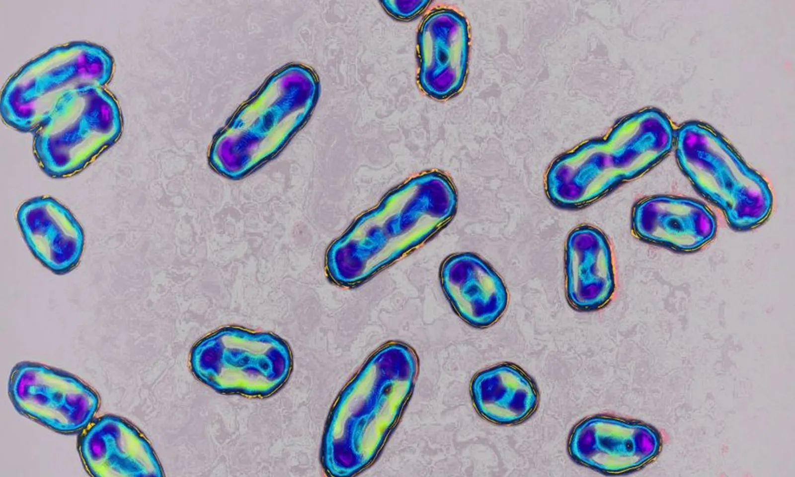 Mỹ phát hiện một cư dân dương tính với bệnh dịch hạch