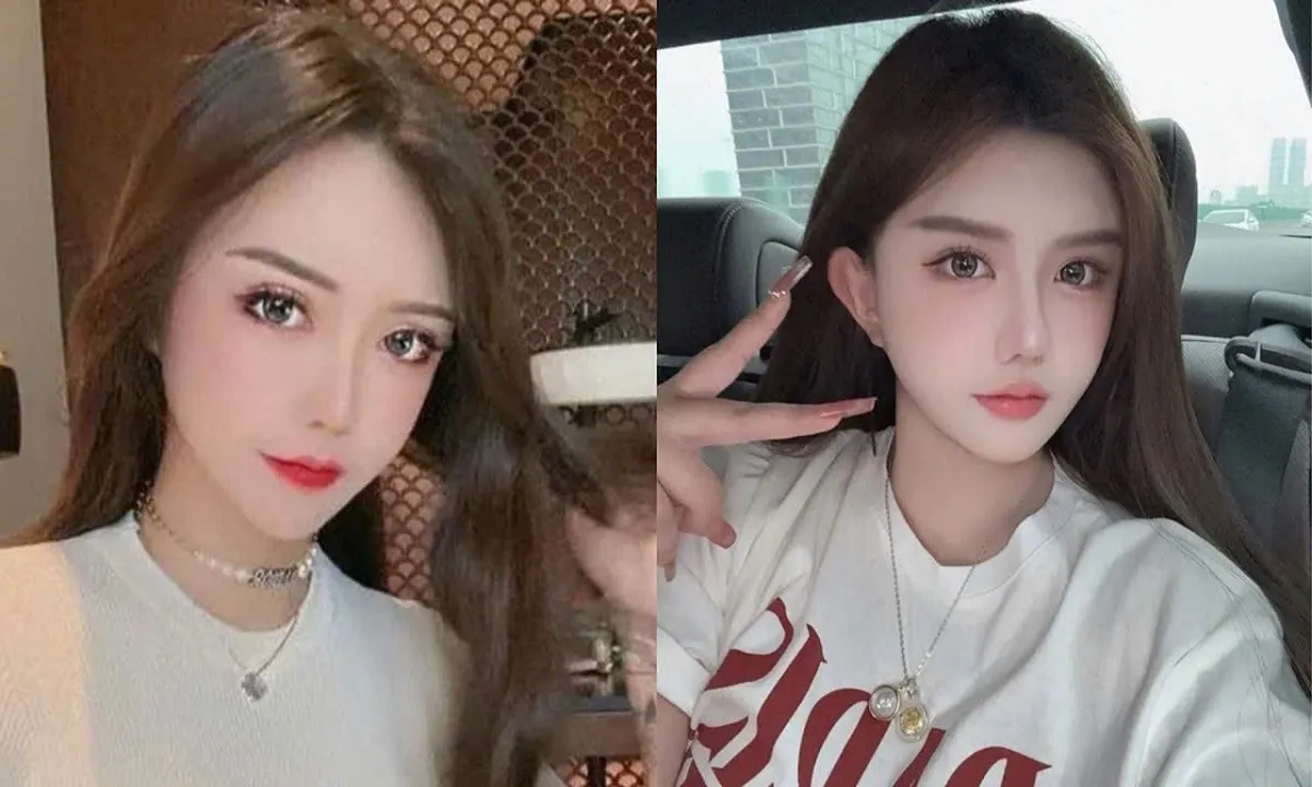 Sự trả giá của hot girl dao kéo khi phẫu thuật thẩm mỹ trong lúc đang mang thai