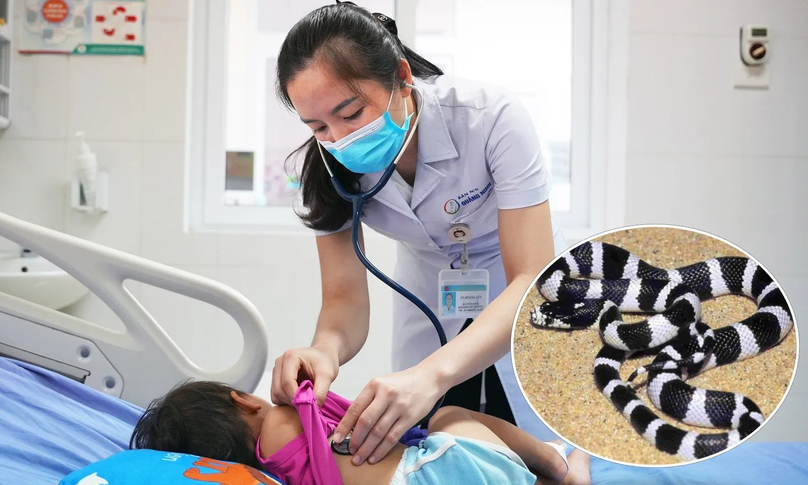 Cứu sống bé 21 tháng tuổi bị rắn cạp nia cắn, hôn mê khi nhập viện 