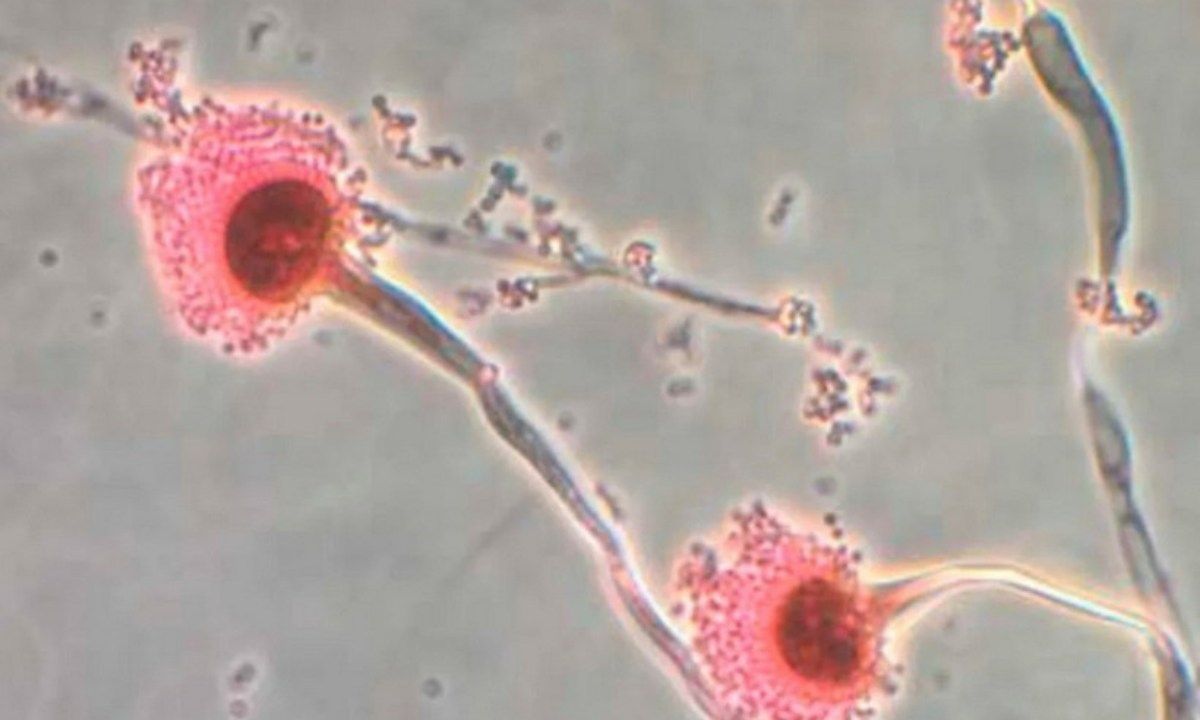 Phát hiện virus “tiếp tay” cho nấm gây chết người