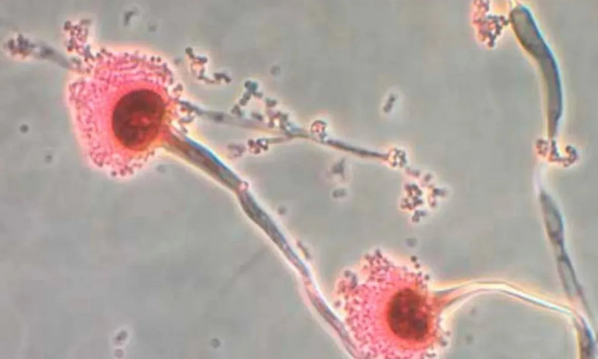 Phát hiện virus “tiếp tay” cho nấm gây chết người