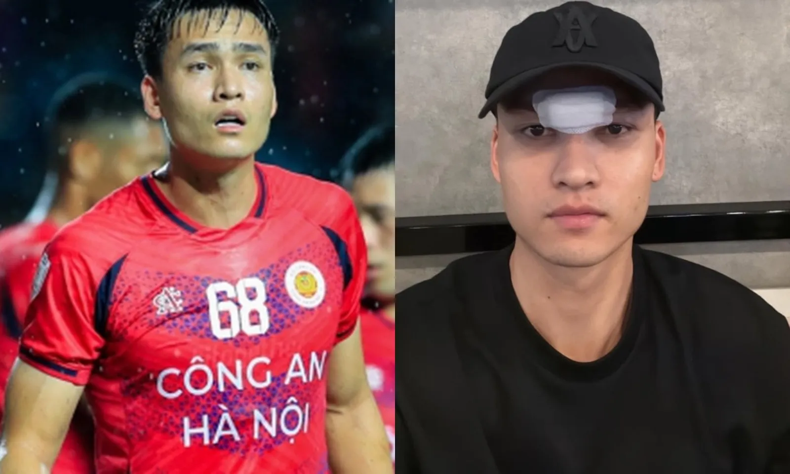 Trung vệ Bùi Hoàng Việt Anh phải khâu 14 mũi sau trận đấu ở Thái Lan