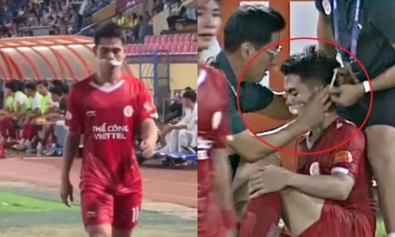 Khuất Văn Khang nhập viện cấp cứu sau pha va chạm mạnh