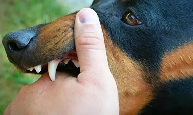 TPHCM: Hai người tử vong vì bệnh dại sau khi bị chó cắn