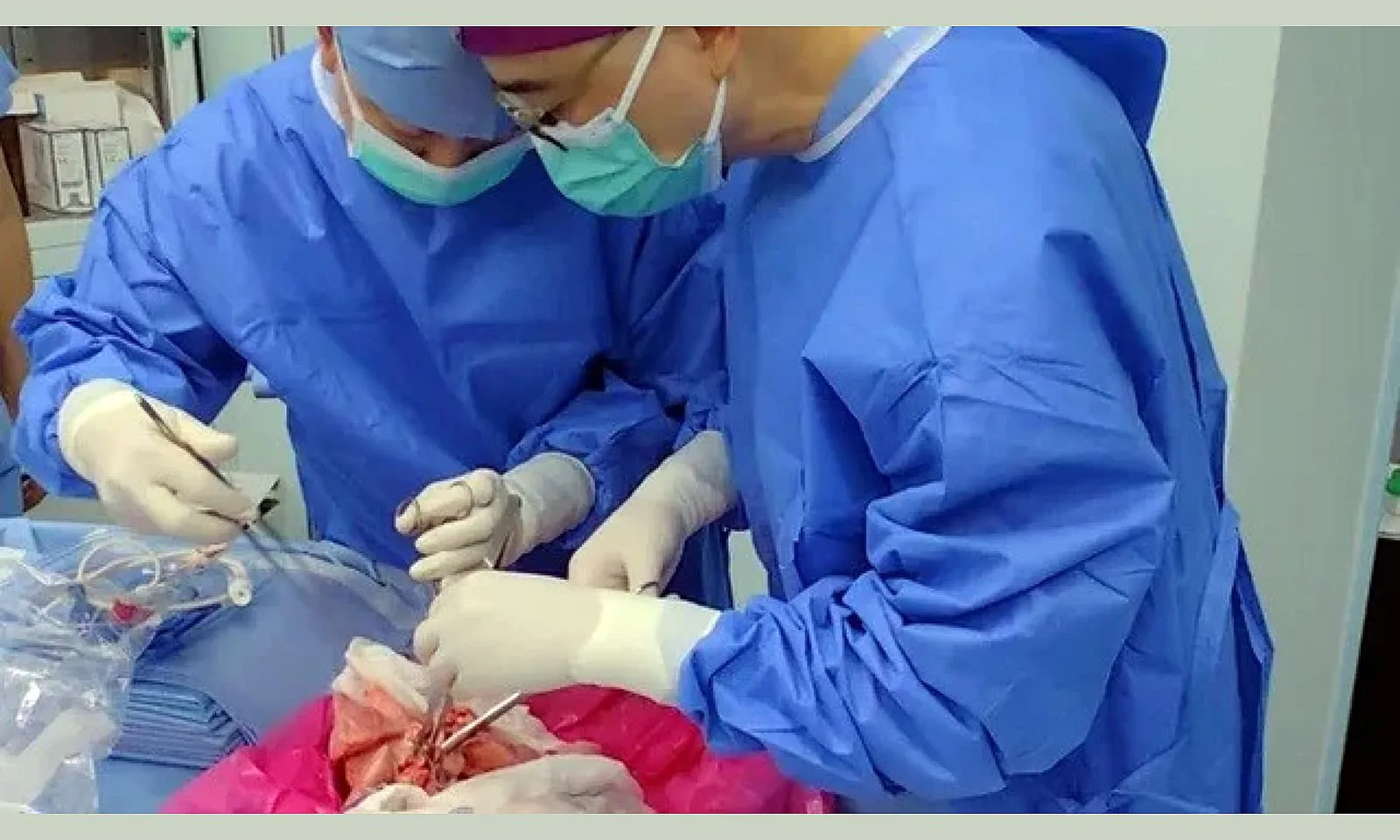 Trung Quốc: Lần đầu tiên phổi heo được ghép thành công cho người