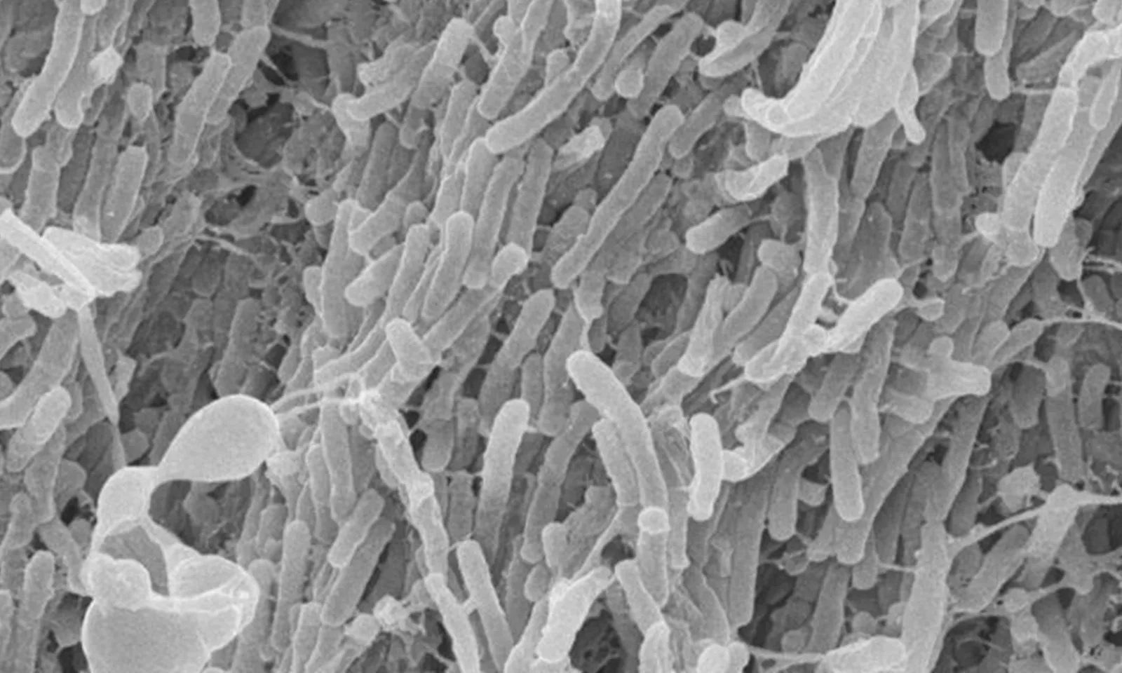 Nhật Bản xét nghiệm lao trước khi nhập cảnh đối với người Việt Nam lưu trú trên 3 tháng