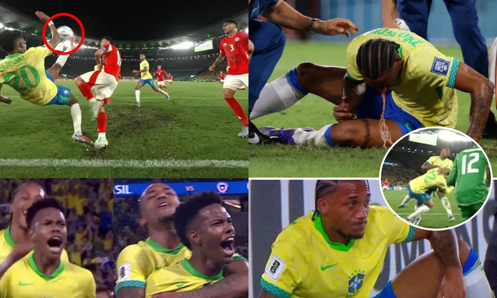 Estevao lập kì tích chỉ kém Pele, Joao Pedro nôn mửa vì va chạm sao Arsenal