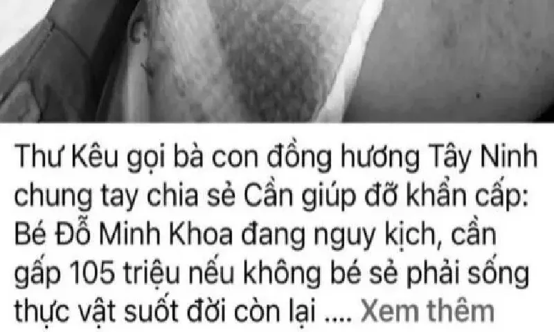 Tây Ninh bác tin giả về bệnh nhi Đỗ Minh Khoa, cảnh báo nguy cơ lừa đảo quyên góp