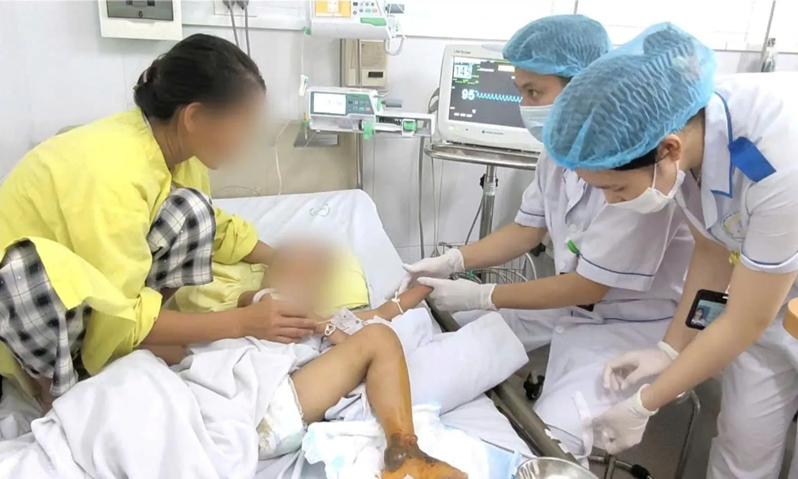 Đắp thuốc nam chữa vết mèo cắn, bé trai 4 tuổi nguy kịch