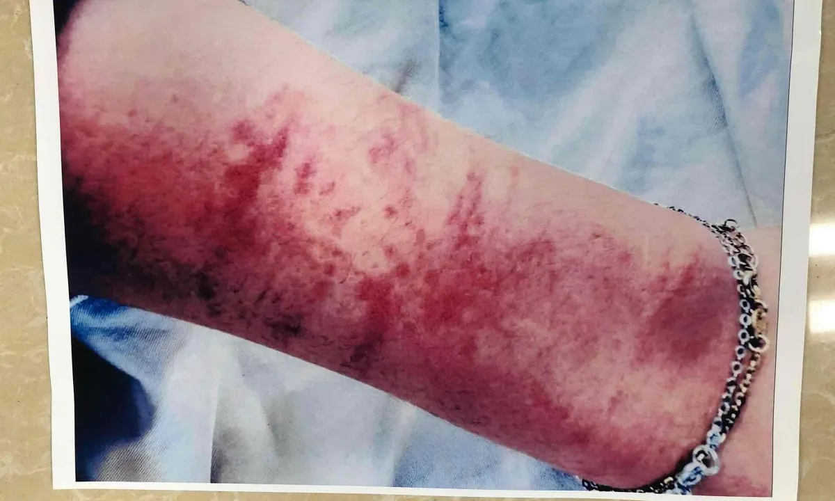 Bác sĩ lãnh 8 năm tù vì hiếp dâm bệnh nhân tại phòng khám