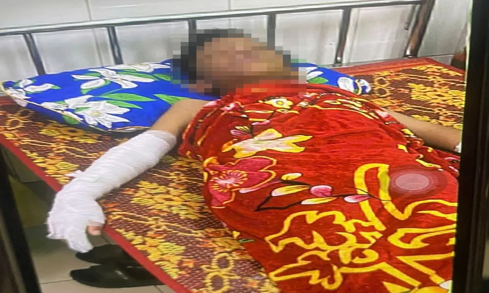 Bé trai 11 tuổi bị bỏng nghiêm trọng sau tiếng nổ bất thường tại sân chơi