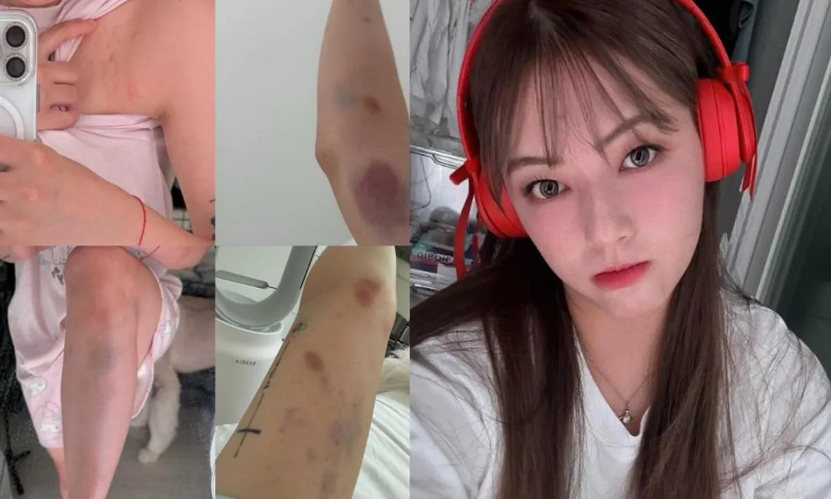 Nữ Youtuber bị hành hung vì từ chối qua đêm với người lạ