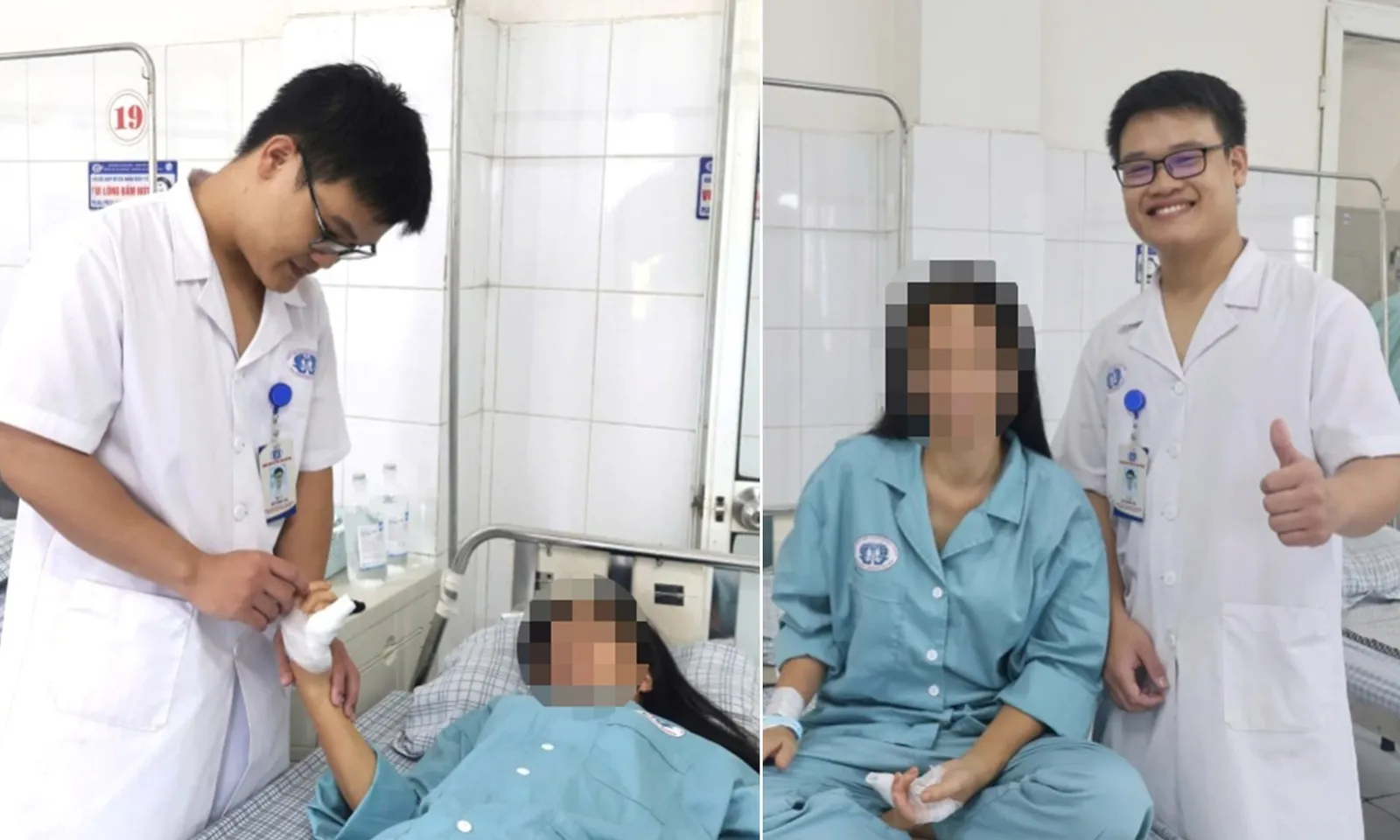 Sốc nhiễm độc, hoại tử ngón tay sau khi bị rắn hổ mang cắn