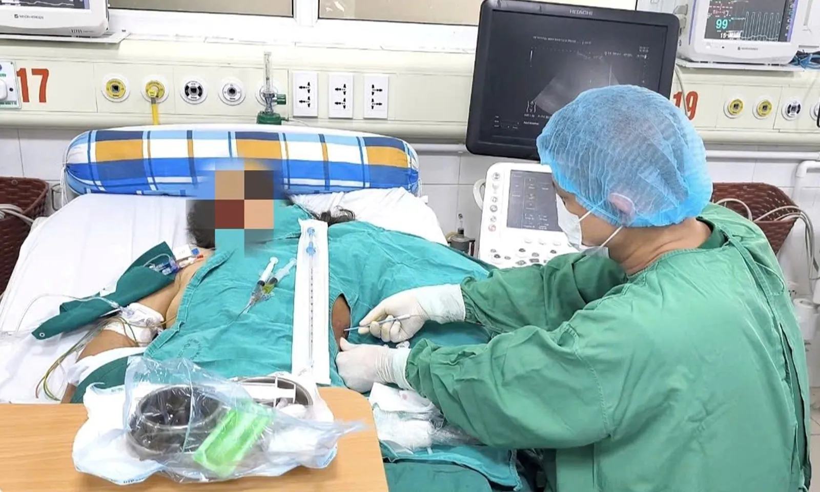 Cụ bà nguy kịch sau khi tiêm thuốc giảm đau vùng cổ